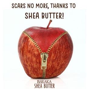 Scars No More, Thanks to Shea Butter!